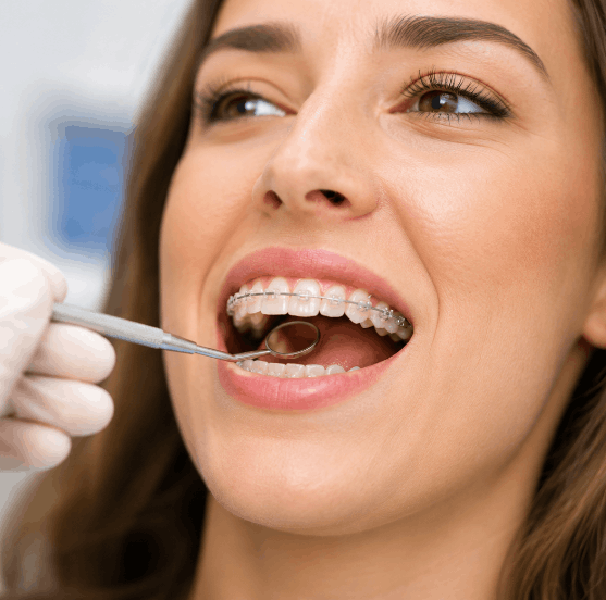 Orthodontie adulte
